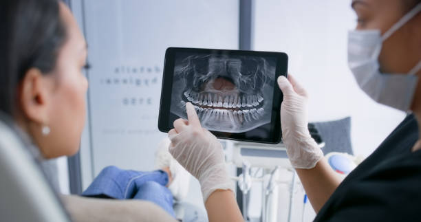 Licensed Tooth Extraction service in Brentwood, CA - Smile Center Dentistry